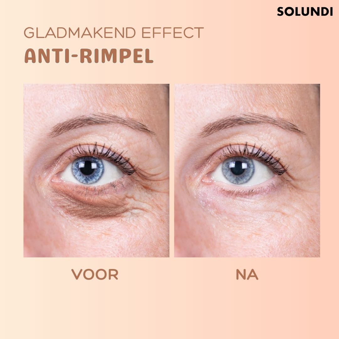 SkinSculpt™ - Anti-rimpel balsem | De nummer een bestseller in het verminderen van rimpels!