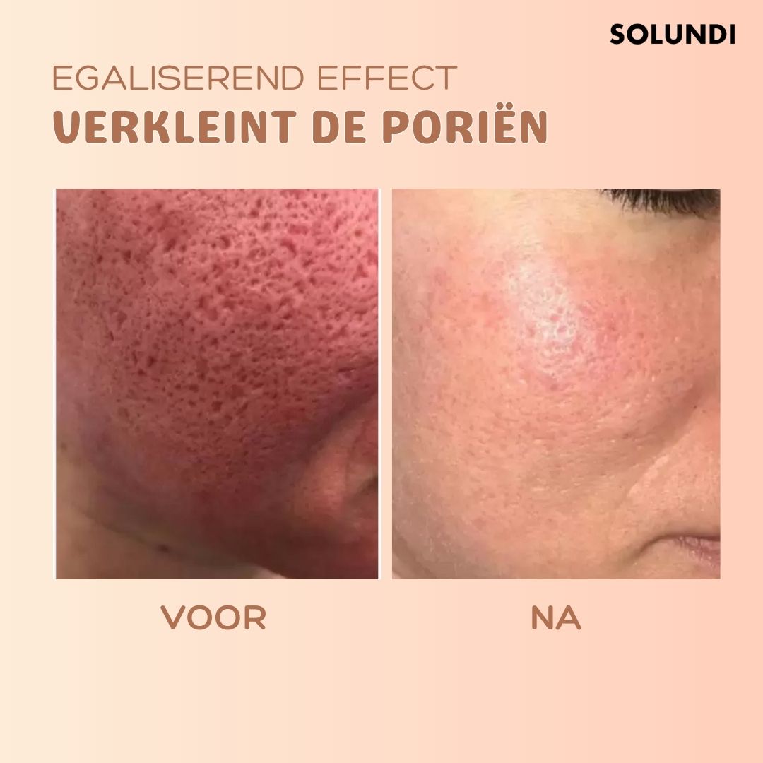 SkinSculpt™ - Anti-rimpel balsem | De nummer een bestseller in het verminderen van rimpels!