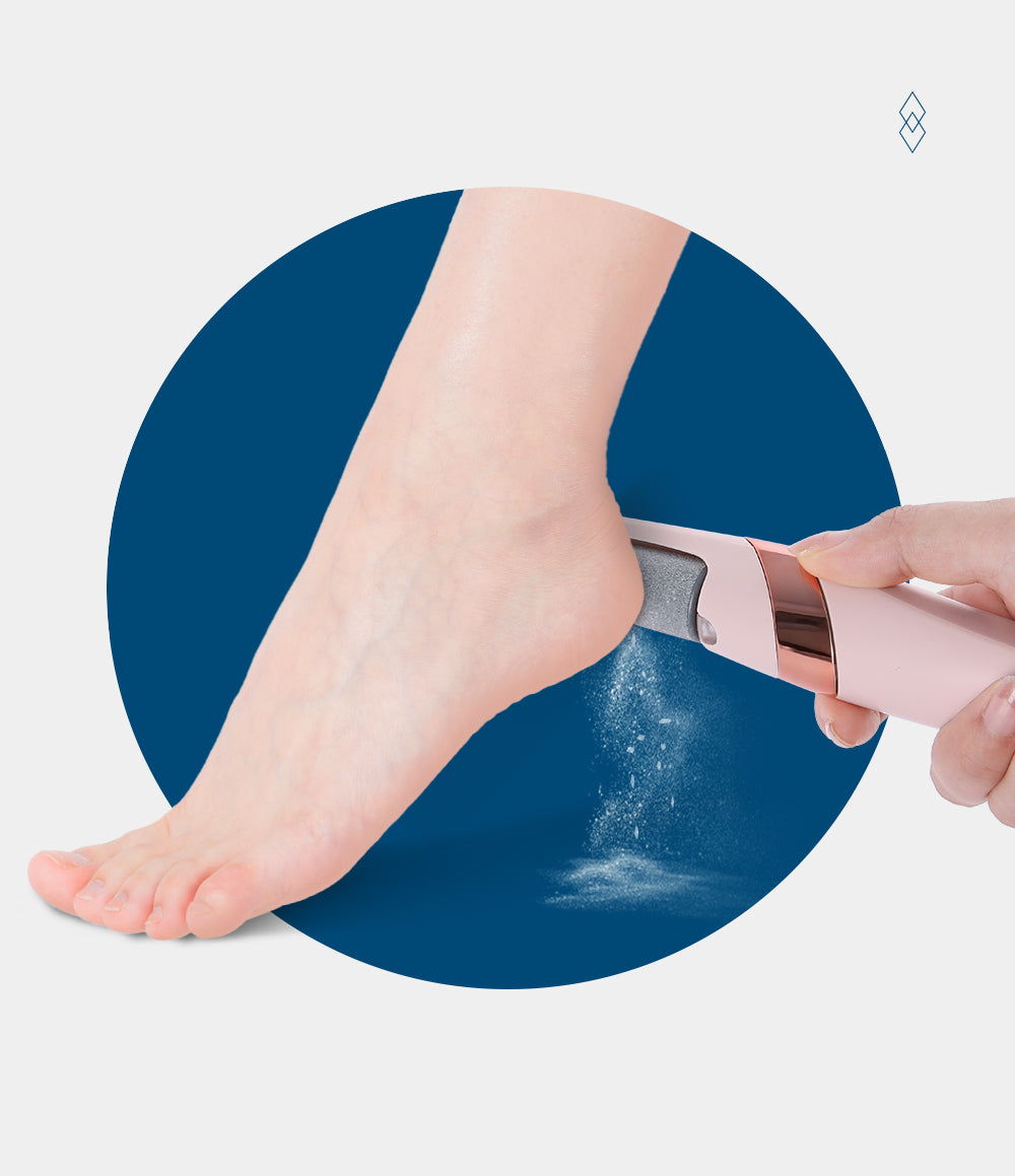 Callus Remover™ | Super zachte hielen en mooie gladde voeten in een mum van tijd!