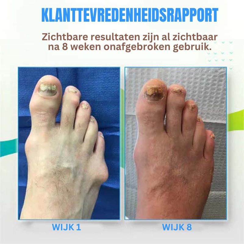 SoleSoothe™ Bunion Verlichtings Sokken