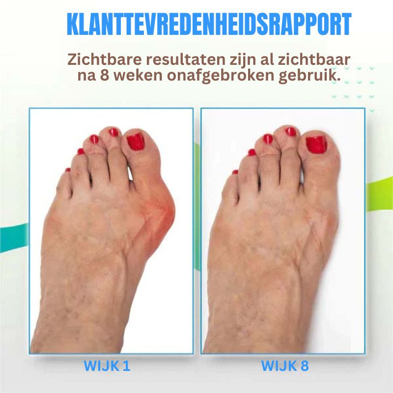 SoleSoothe™ Bunion Verlichtings Sokken