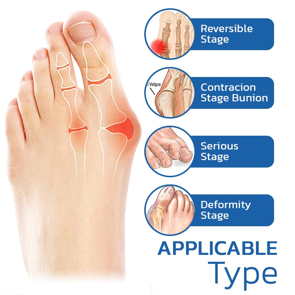 Projoint | AntiBunions gezondheidssok