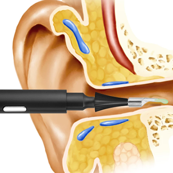 The ear doctor™ | Houdt uw oren gezond